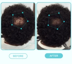Spot Fixer Growth Serum